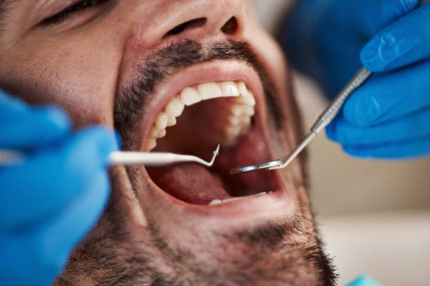 Best Emergency Root Canal Therapy in Pascoag, RI